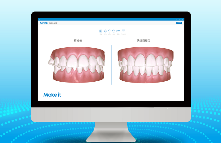 传统硅胶取模到底比3d口扫取模差在哪儿?