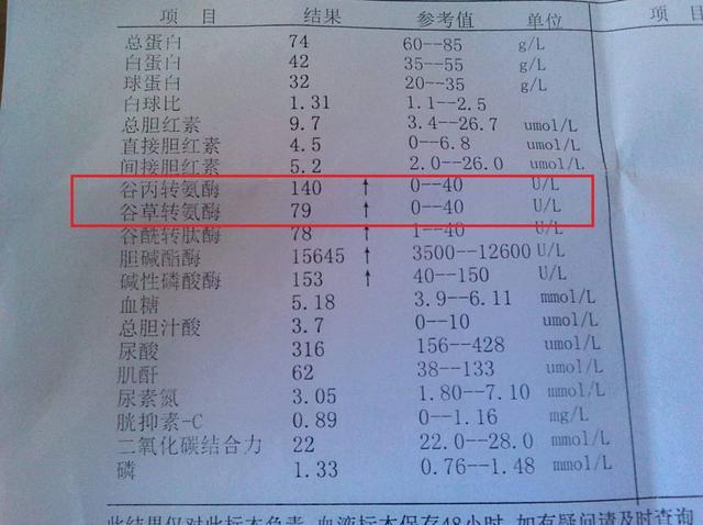 体检时,如果这4个指标都正常,说明"肝功能"很好,值得恭喜