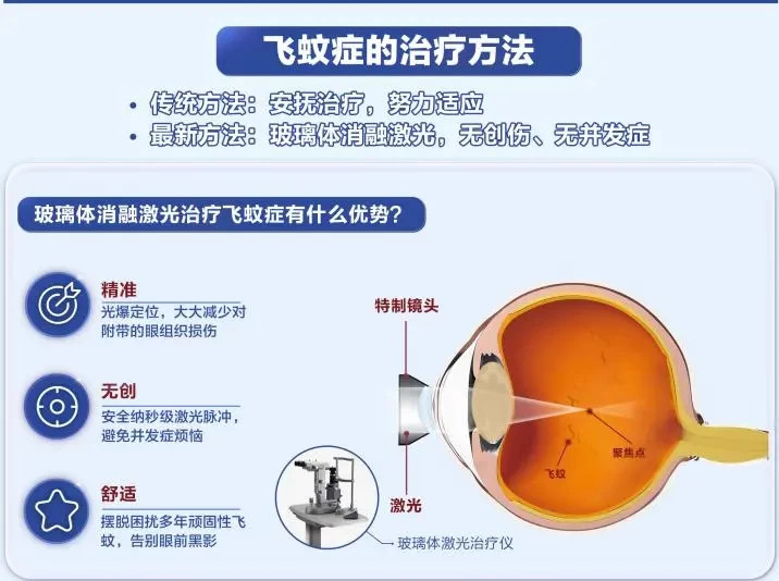 飞蚊症是不是治不好