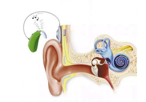 是"谁"影响了人工耳蜗植入效果?