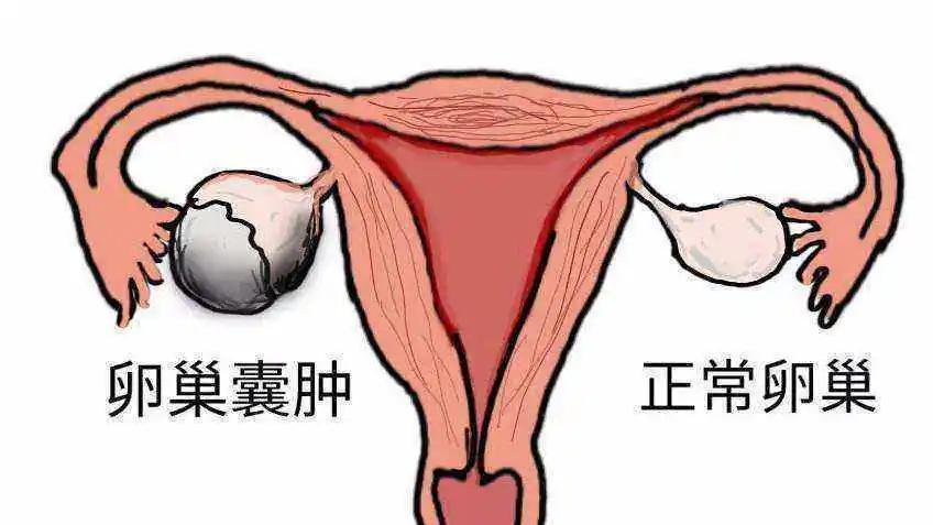 惊了!女性经常生气会诱发乳腺癌,卵巢囊肿等多种疾病