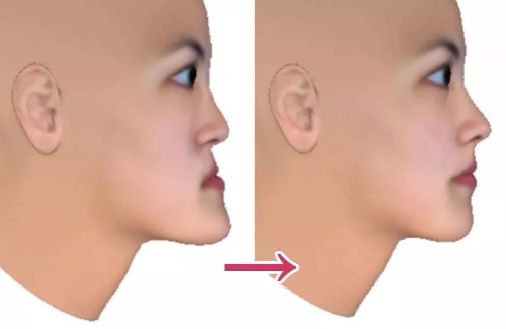 明明是狼性学霸,却被嘲没女主脸,蓝盈莹凹面脸型牙齿背锅?