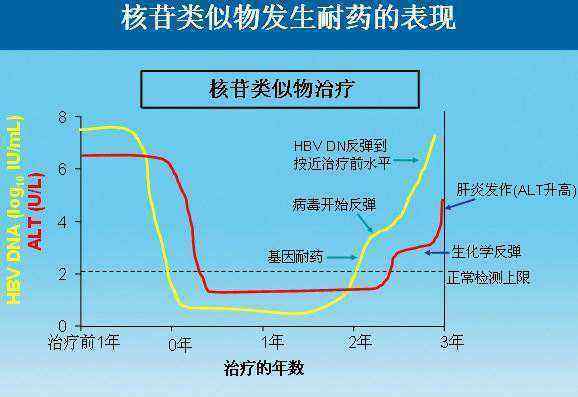 乙肝替诺福韦TDF48周试验，单药抗病毒作用明显，肝功能持续改善