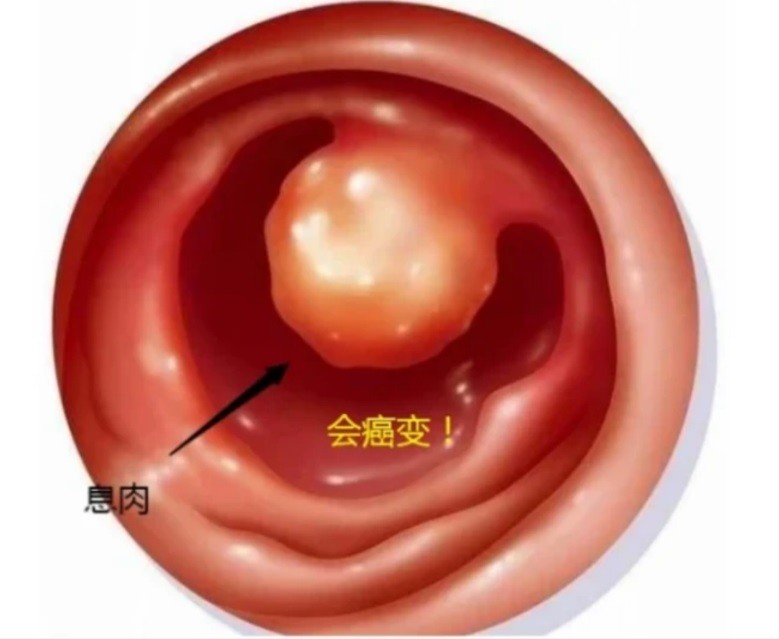 冰箱打死不能放“3种食物”，滋生细菌，别吃没了健康，早知早好！