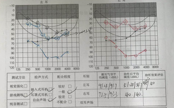 警惕新生儿听力筛查通过听力没问题