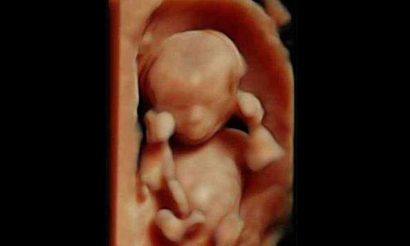 2,孕6个月(21-24周)胎宝宝像个大茄子,越来越好看了哦 孕6个月宝宝的