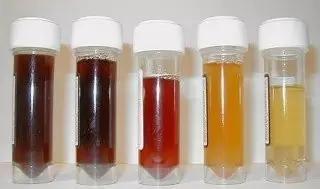 (4)黄褐色尿液:一般常见于黄疸病人.