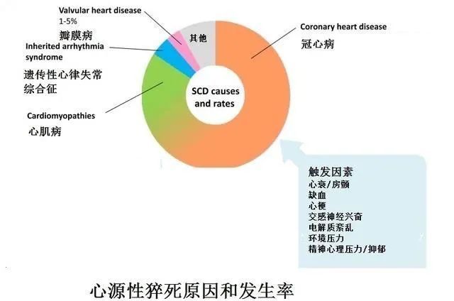 心肌梗塞比例人口_心肌梗塞(2)