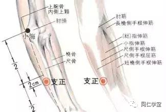 支正穴:头痛,目眩,热病,癫狂