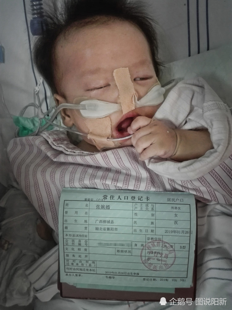 2月女婴患白血病，ICU一月签13张病危书，妈妈抑郁放弃时：宝宝笑了