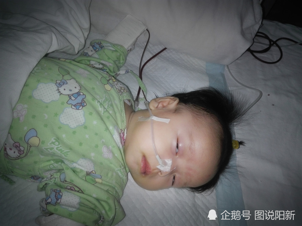 2月女婴患白血病，ICU一月签13张病危书，妈妈抑郁放弃时：宝宝笑了
