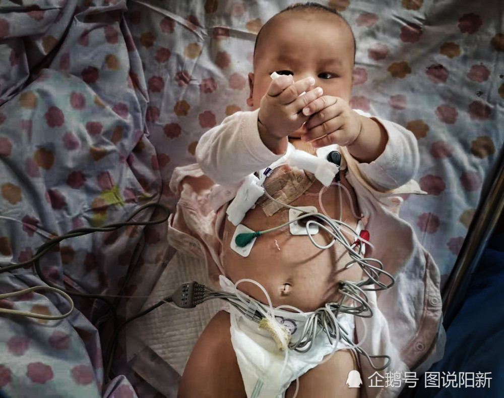 2月女婴患白血病，ICU一月签13张病危书，妈妈抑郁放弃时：宝宝笑了