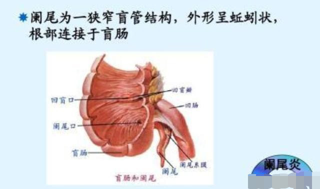 古时候的人要是得了阑尾炎怎么办呢还是直接痛死