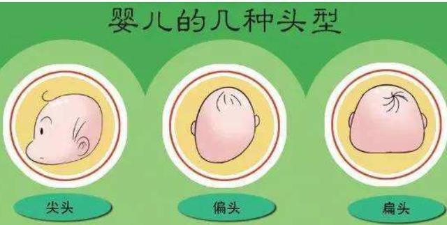 "妈妈别再给我睡扁头,扁头的危害,不只在于影响宝宝的颜值