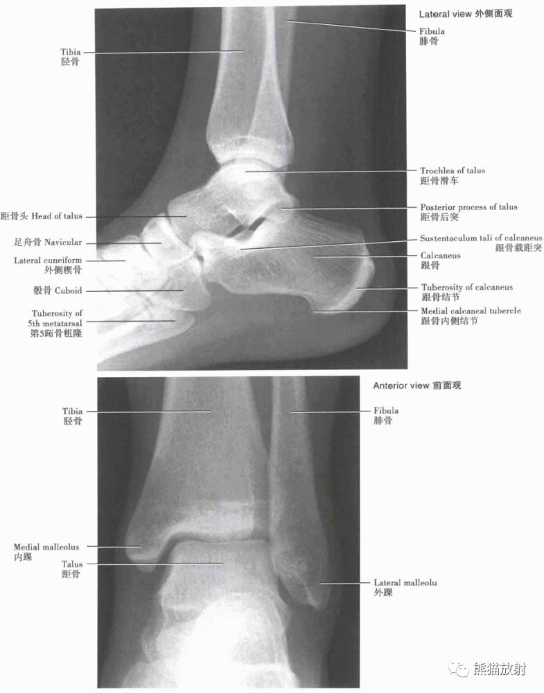 奈特解剖:超清晰的下肢解剖图,收藏!