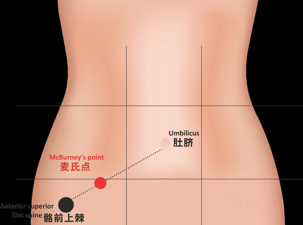 棘,也就是叉腰时手扶的骨盆前侧最突出的部分,髂前上棘连接肚脐的直线