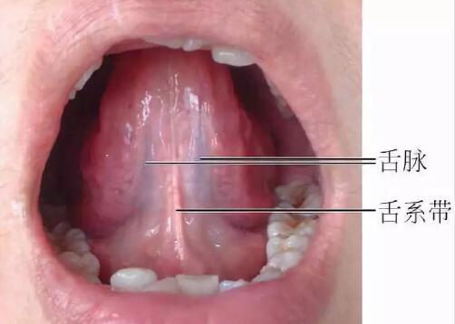猛然发现舌头下面有很多突出的黑筋,什么病?需要如何治疗