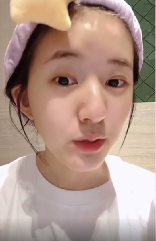 赵露思卸妆后素颜出镜离开10级滤镜ps看清皮肤太真实了