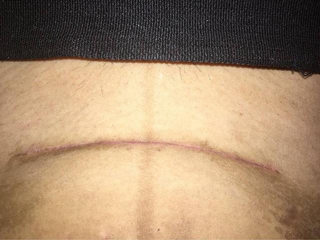 分娩方式首选剖腹产?先别急,做好这些心理准备再决定!