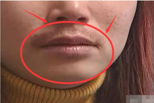 女生嘴巴上为什么会长"胡子"?若能做到这3点,秒变回小