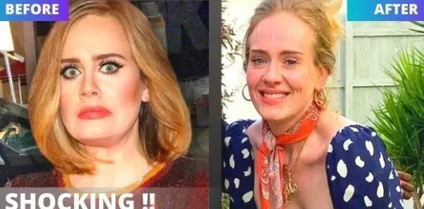 邓超2个月暴瘦40斤！孙俪哭诉不许再减！减肥过快到底有什么危害？