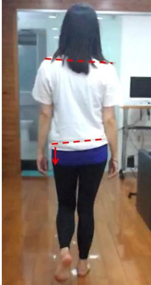 膝痛很久应该减少运动吗？小心恶性循环！
