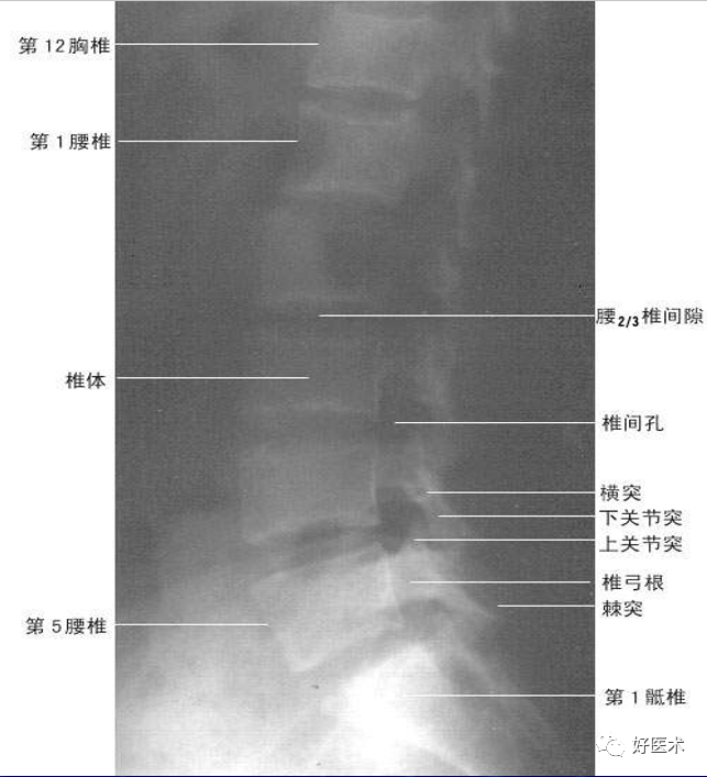 (二)脊柱与脊髓断面影像解剖