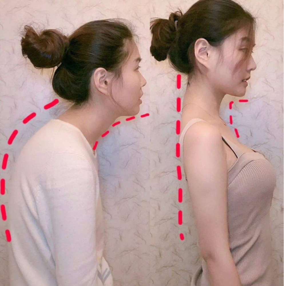 还在圆肩驼背？学会这几个动作，助你重拾挺拔身姿