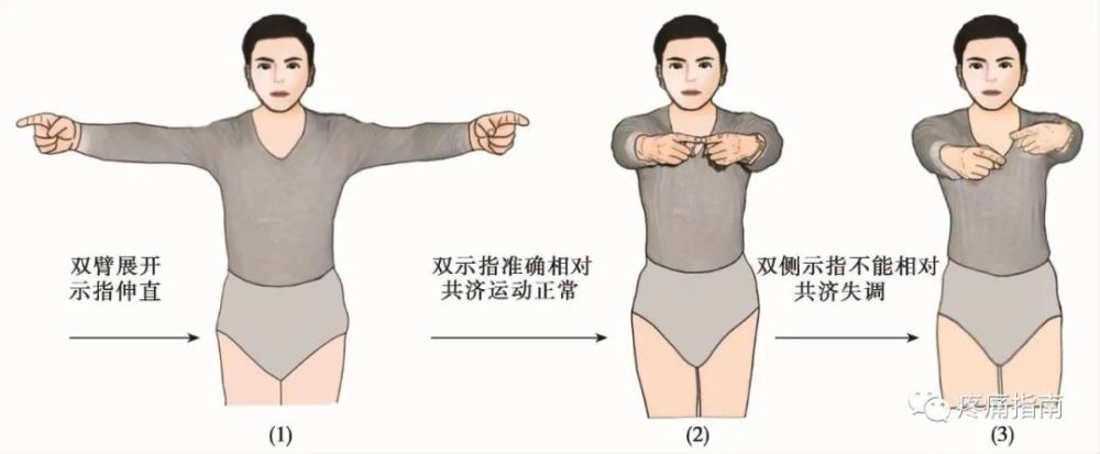 运动查体肌肉各论（九）