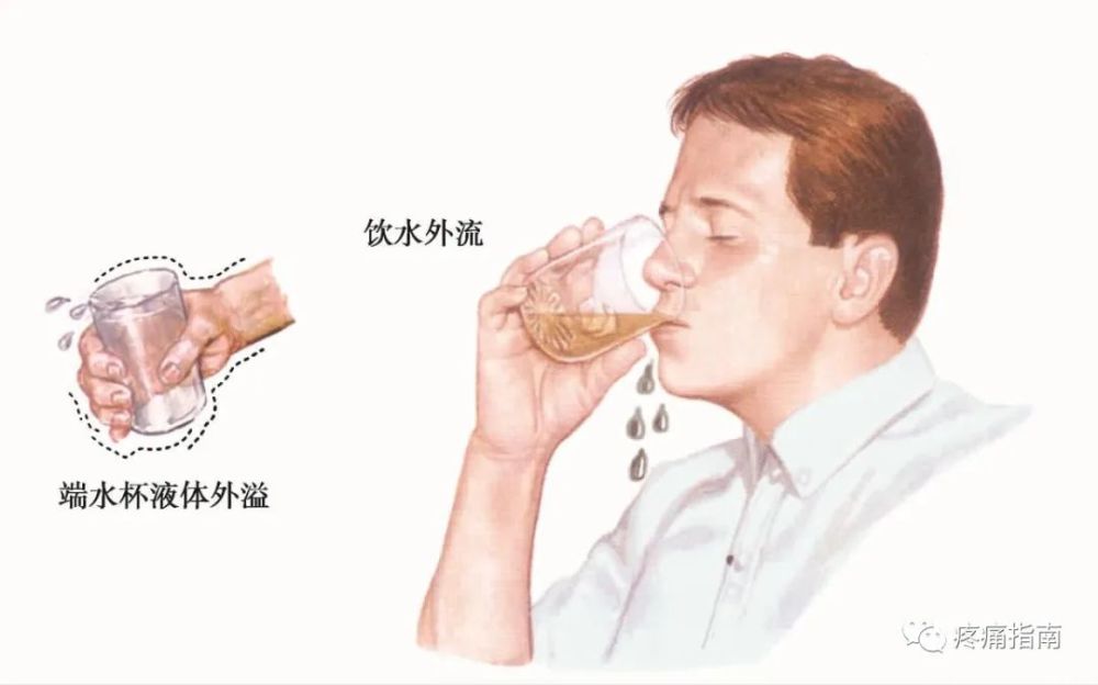 运动查体肌肉各论（九）