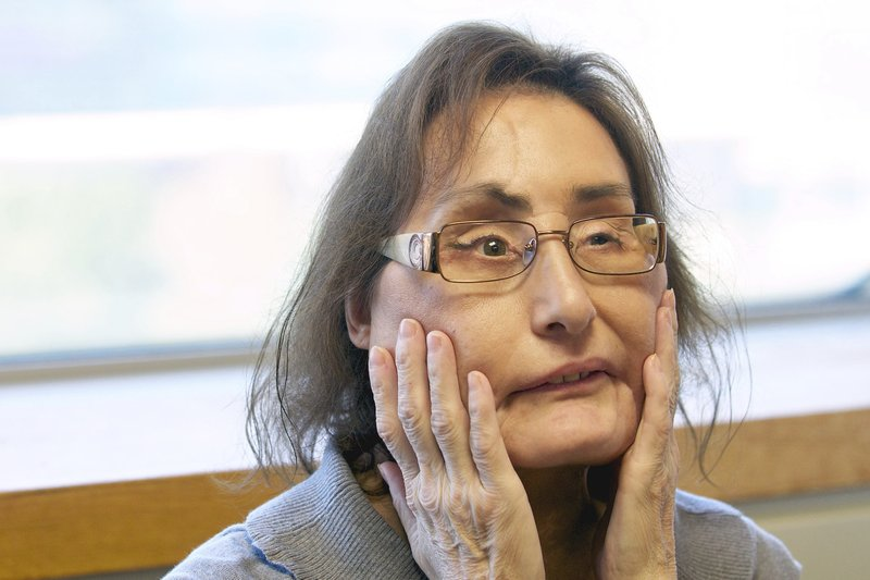 世界最长寿换脸女子去世，被丈夫崩了一枪，八成面部结构被替换