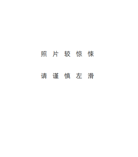 世界最长寿换脸女子去世，被丈夫崩了一枪，八成面部结构被替换