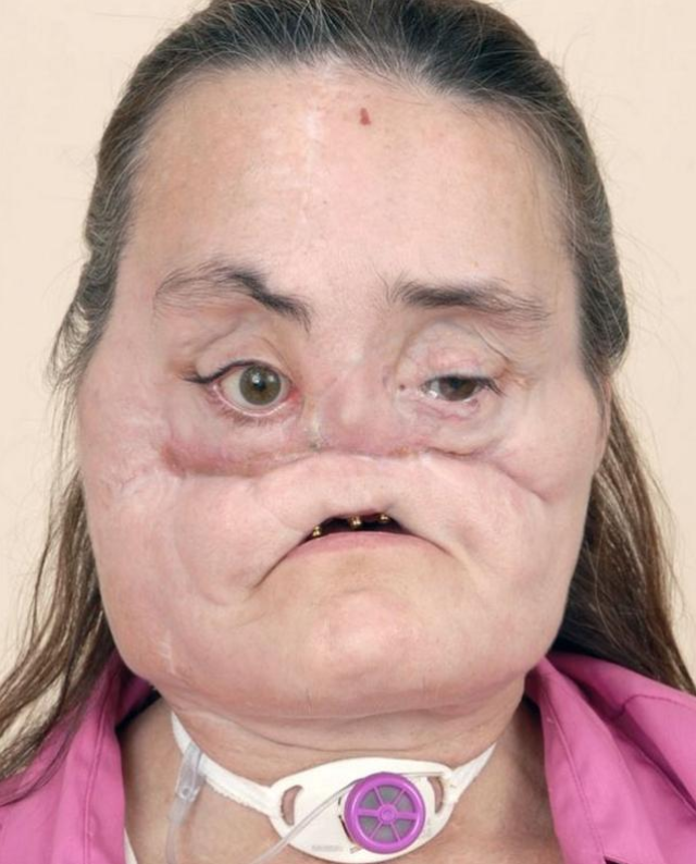 世界最长寿换脸女子去世，被丈夫崩了一枪，八成面部结构被替换