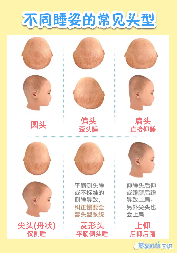 宝宝正确睡姿如何睡出完美头型,新手爸妈看过来