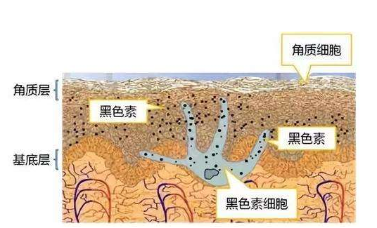 黑色素在白癜风中扮演的角色有多重要?
