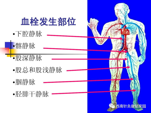 全身主干静脉均可发病,尤其是下肢静脉.