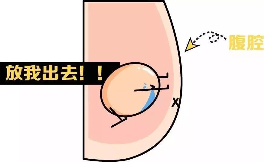 对孩子危害极大的"隐睾",家长该如何正确应对?