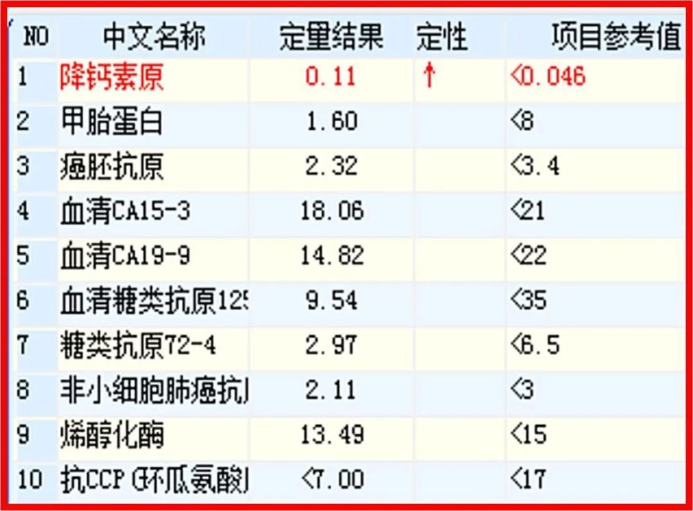 【肿瘤标志物检验报告】