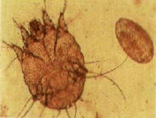 猪疥螨虫及虫卵