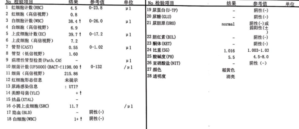 蛋白尿包括生理性蛋白尿和病理性蛋白尿.生理性蛋白