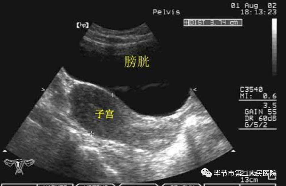 【科室科普】超声检查前的准备