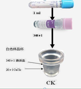 血栓弹力图，“弹”的是什么？