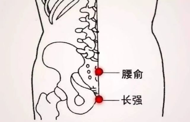 针灸治疗腰椎间盘突出症