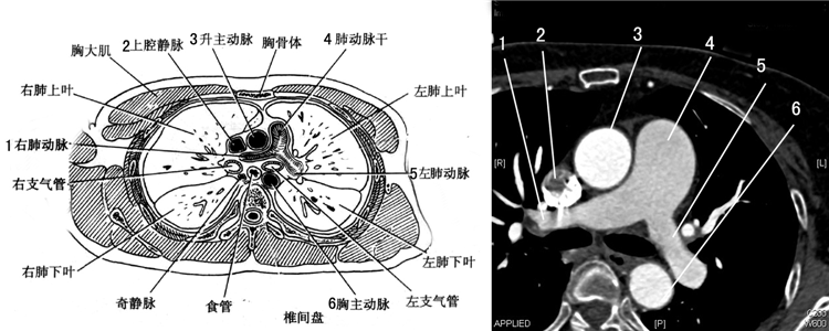 心脏的这些ct切面图像,你都能识别吗?