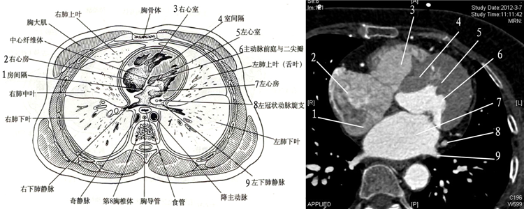 心脏的这些ct切面图像,你都能识别吗?