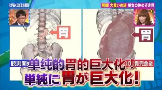 大胃王暴吃不胖靠催吐？医生：此举收效甚微，还有风险