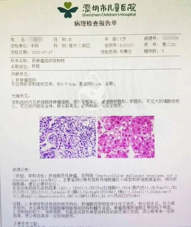 7岁女孩确诊晚期肝癌，乙肝妈妈们要注意，这个错误千万不能犯