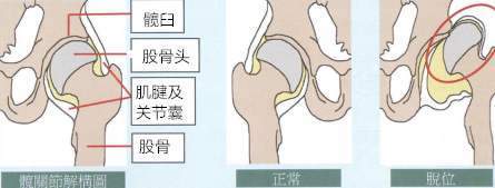 髋关节活动是怎么回事_髋关节活动受限是什么原因引起的呢