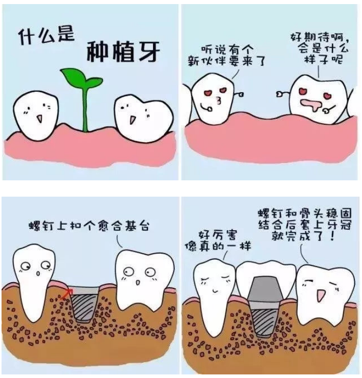 种植牙的坏处?