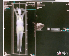 3分钟扫描全身,四大特质护航!世界首款全景动态pet-ct